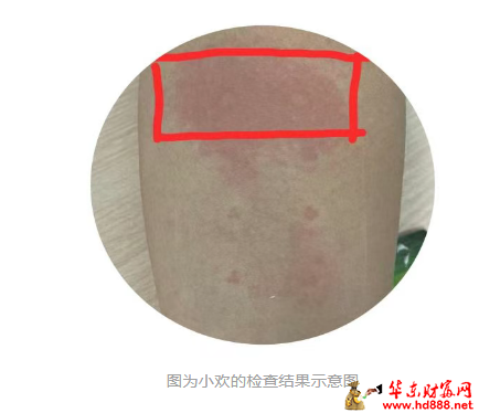 快速確認(rèn)過敏原，自由擁抱春天
